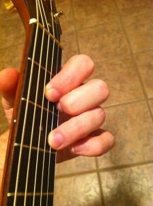 DM